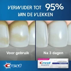 Alternative view of Aanbiedingen ???? Crest 3D White Brilliance Toothpaste - Tandpasta Voor Wittere Tanden En Intensieve Bleek- En Glazuurbehandeling - Tandpasta Whitening - 3 X 75 Ml ????