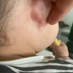 Alternative view of Beste deal ???? Ouini's Olie Ouini's Knoflookolie- Haar Uitval - Haargroei Olie - Knoflook Olie - Eczeem- Acne - Psoriasis - Rosacea - Alopecia - Baardgroei ????